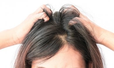 Prurito al cuoio capelluto? 7 rimedi naturali per calmarlo