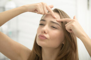 Acne giovanile e tardiva: eliminarla in 8 mosse
