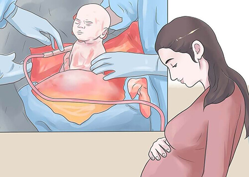 Paura del parto cesareo: come superarla