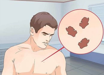 Neo sospetto: come riconoscerlo e cosa fare?