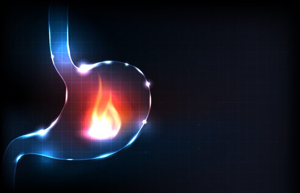 Sintomi dell'acidità