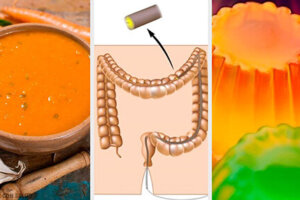 Colonscopia: quale dieta seguire e come prepararsi