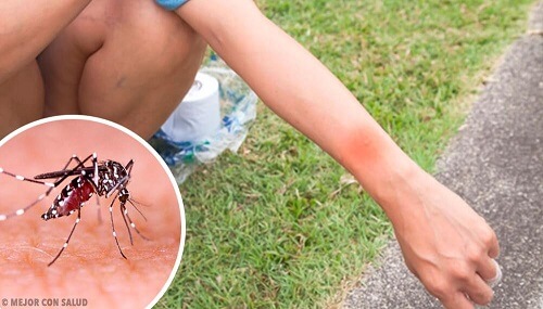 Grattare una puntura di zanzara: quali conseguenze?