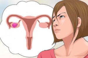 Cancro delle ovaie: effetti collaterali