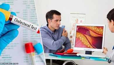 Livello di colesterolo ottimale: quando preoccuparsi?