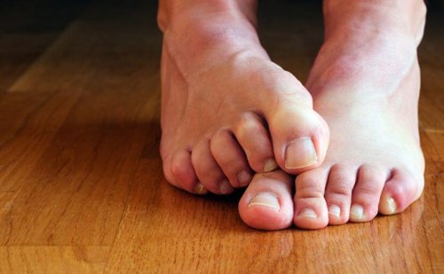 La micosi alle unghie causa dolore?