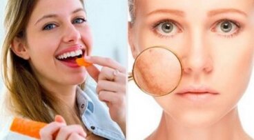 9 alimenti per prendersi cura della pelle