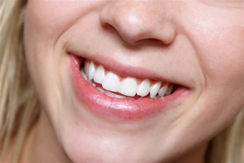 Donna con denti bianchi