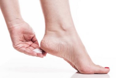 I calli ai piedi: come ridurli con 7 rimedi naturali