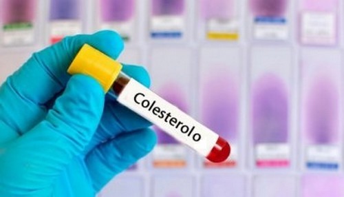 Piante per abbassare il colesterolo alto nel sangue