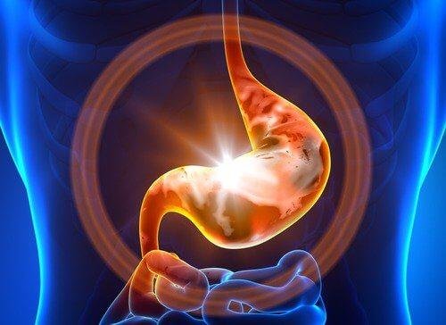 Rappresentazione della gastroenterite