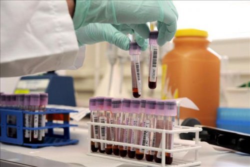 Provette con campioni di sangue