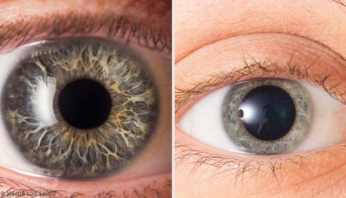 Dilatazione delle pupille