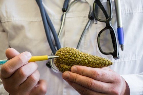 Medico tiene in mano modello di pancreas