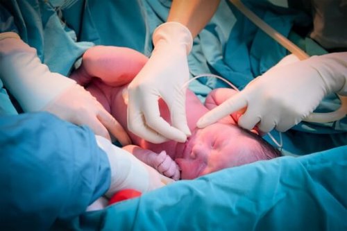 Neonato con asfissia perinatale