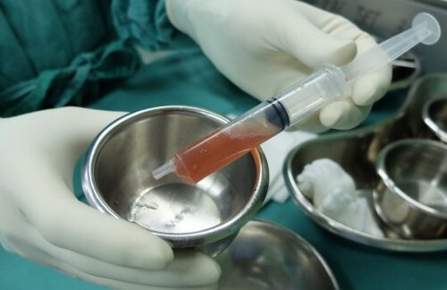 Ascite: definizione, consigli e trattamenti