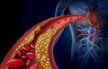 La corretta dieta per abbassare i trigliceridi