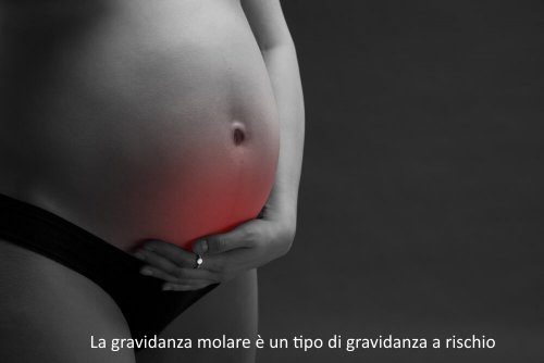 Gravidanza molare