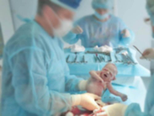 Patologie chirurgiche del neonato