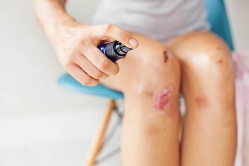 Trattare una ferita in modo corretto