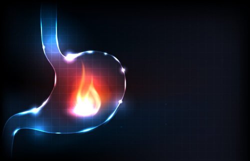 Bruciore e acidità di stomaco