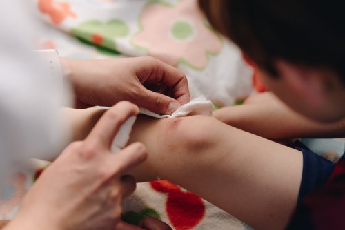 Mamma disinfetta ferita al ginocchio del bambino