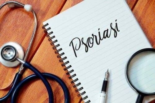 Prevenire la psoriasi grazie a 5 abitudini