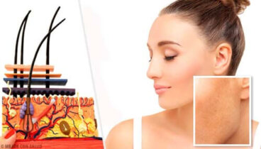 Cause delle macchie sulla pelle: perché compaiono?