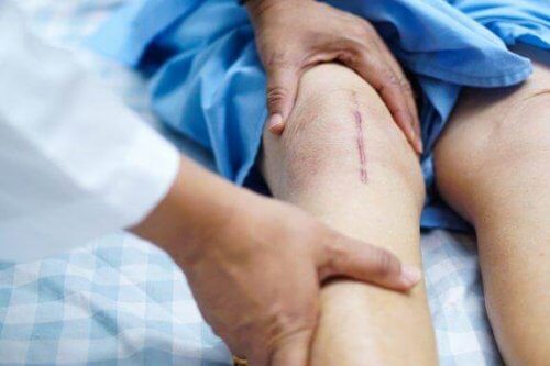 Trapianto di ginocchio e recupero post operatorio