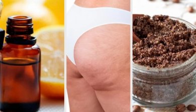 Rimedi naturali per combattere la cellulite