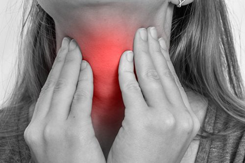 Gola irritata e rimedi naturali per ottenere sollievo