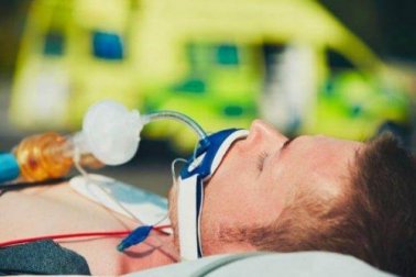 Tubo endotracheale: cos'è e come si usa?