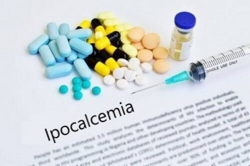 Ipocalcemia: sintomi e trattamento