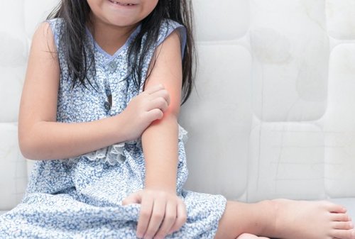 La psoriasi nei bambini: come trattarla?
