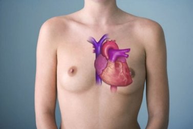 Tronco arterioso comune: fattori di rischio