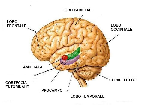 Effetti della depressione sul cervello