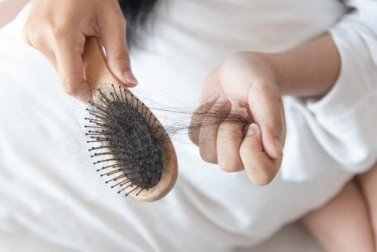 Fermare la caduta dei capelli con i rimedi naturali