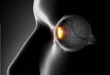 Strabismo: sintomi e cure