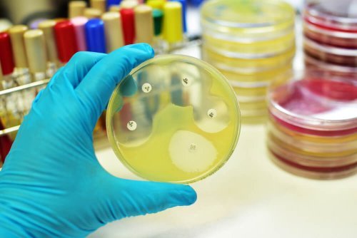 Tecnico analizza campione di urina in laboratorio