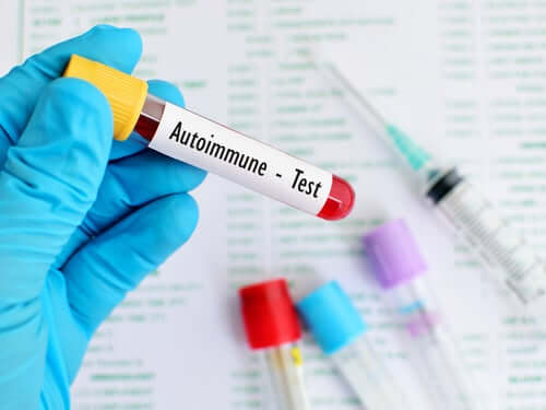 Analisi del sangue malattie autoimmuni