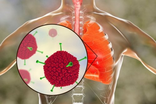 Adenovirus della sindrome respiratoria acuta grave