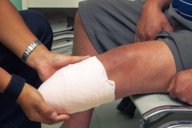 Amputazione sovracondiloidea: 14 fasi