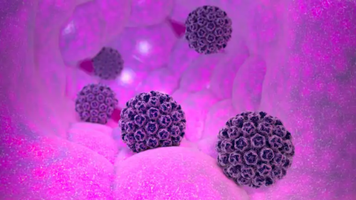 Hpv virus.