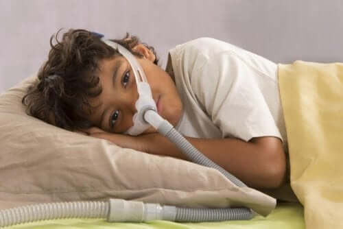 Apnea ostruttiva del sonno nei bambini