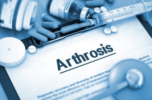 Artropatia degenerativa: cause e sintomi