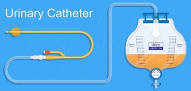 Ritenzione urinaria post-partum: trattamento
