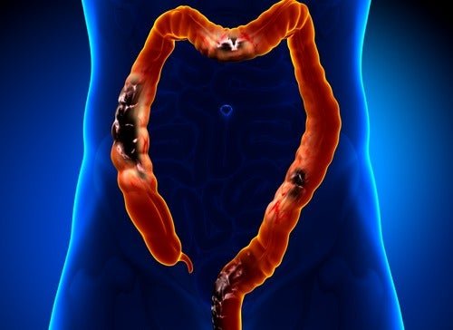 Esemplificazione dell'intestino