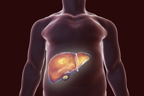 Dieta per i calcoli biliari: gli alimenti più indicati