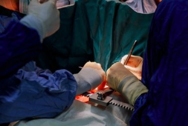 Lesione dell'aorta: come si interviene?