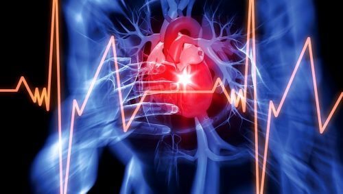 Elettrocardiogramma per rilevare il versamento pericardico